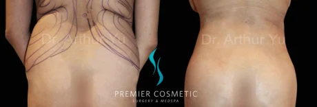 Hourglass Sculpting case #19099