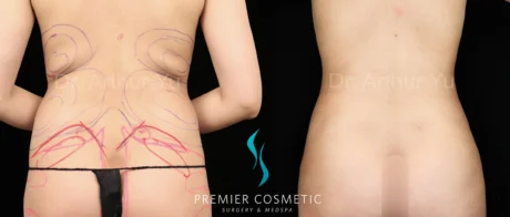 Hourglass Sculpting case #19095