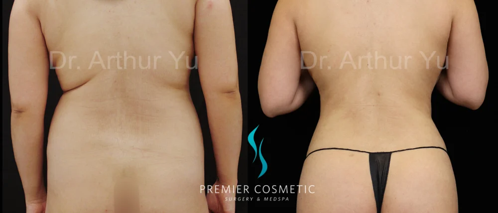 Hourglass Sculpting case #19107