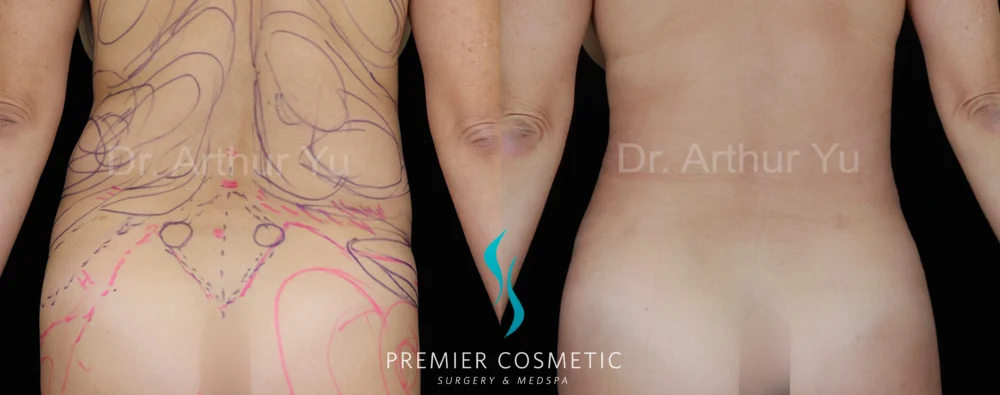 Hourglass Sculpting case #19105